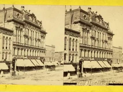 Stereograph
